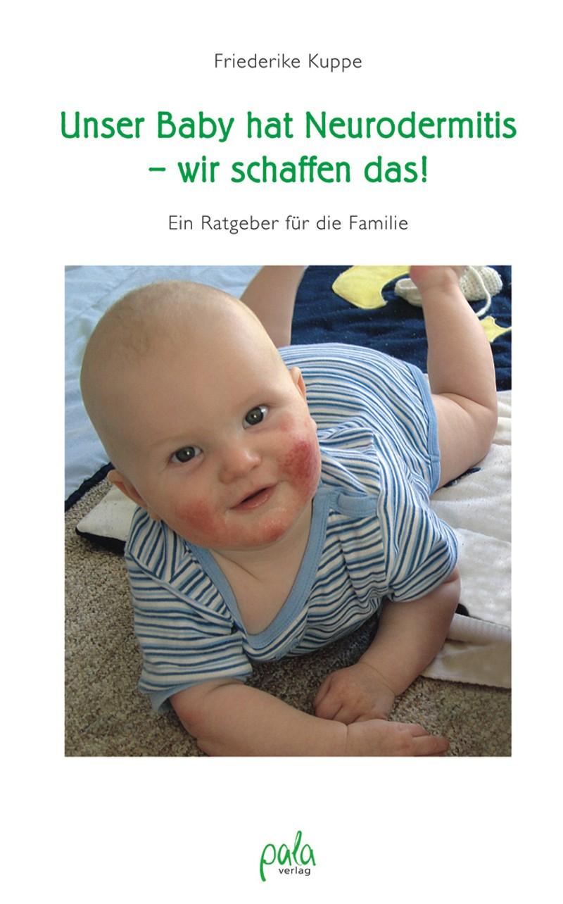 Vorderes Coverbild Unser Baby hat Neurodermitis - wir schaffen das!