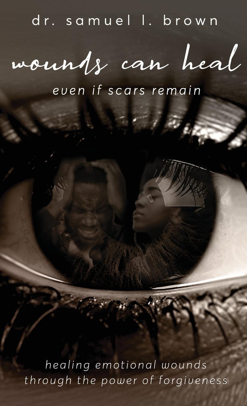 Vorderes Coverbild Wounds Can Heal, Healing Emotional Wounds Through the Power of Forgiveness