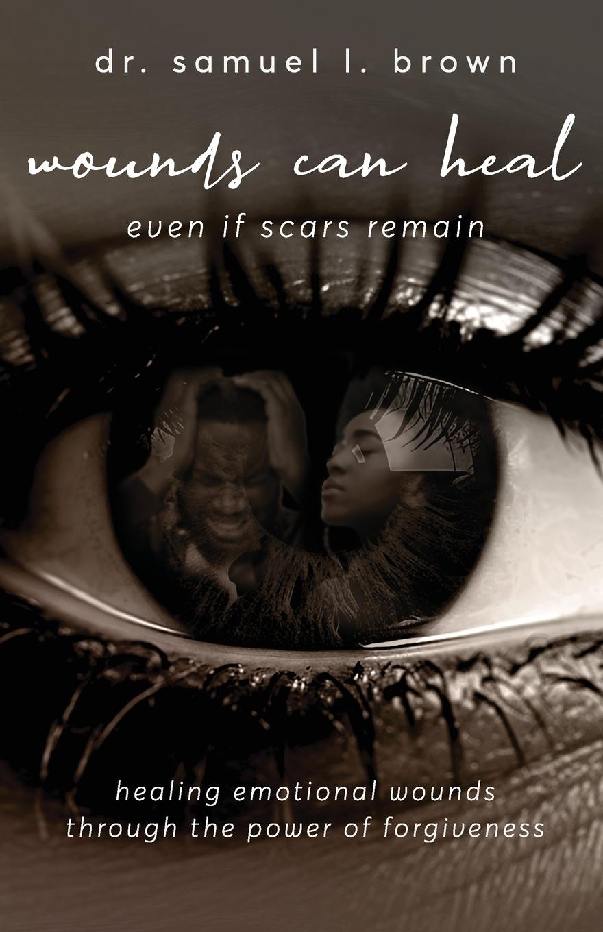 Vorderes Coverbild Wounds Can Heal, Even If Scars Remain