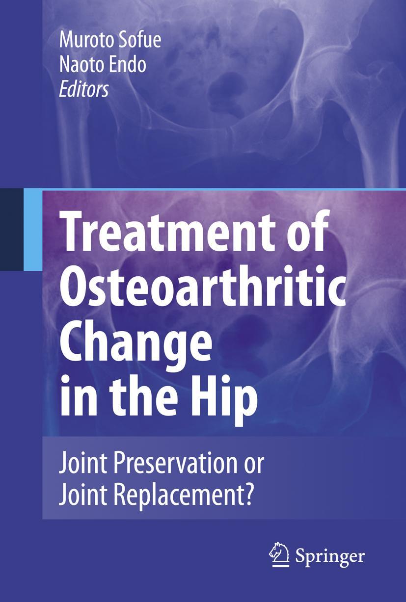 Vorderes Coverbild Treatment of Osteoarthritic Change in the Hip