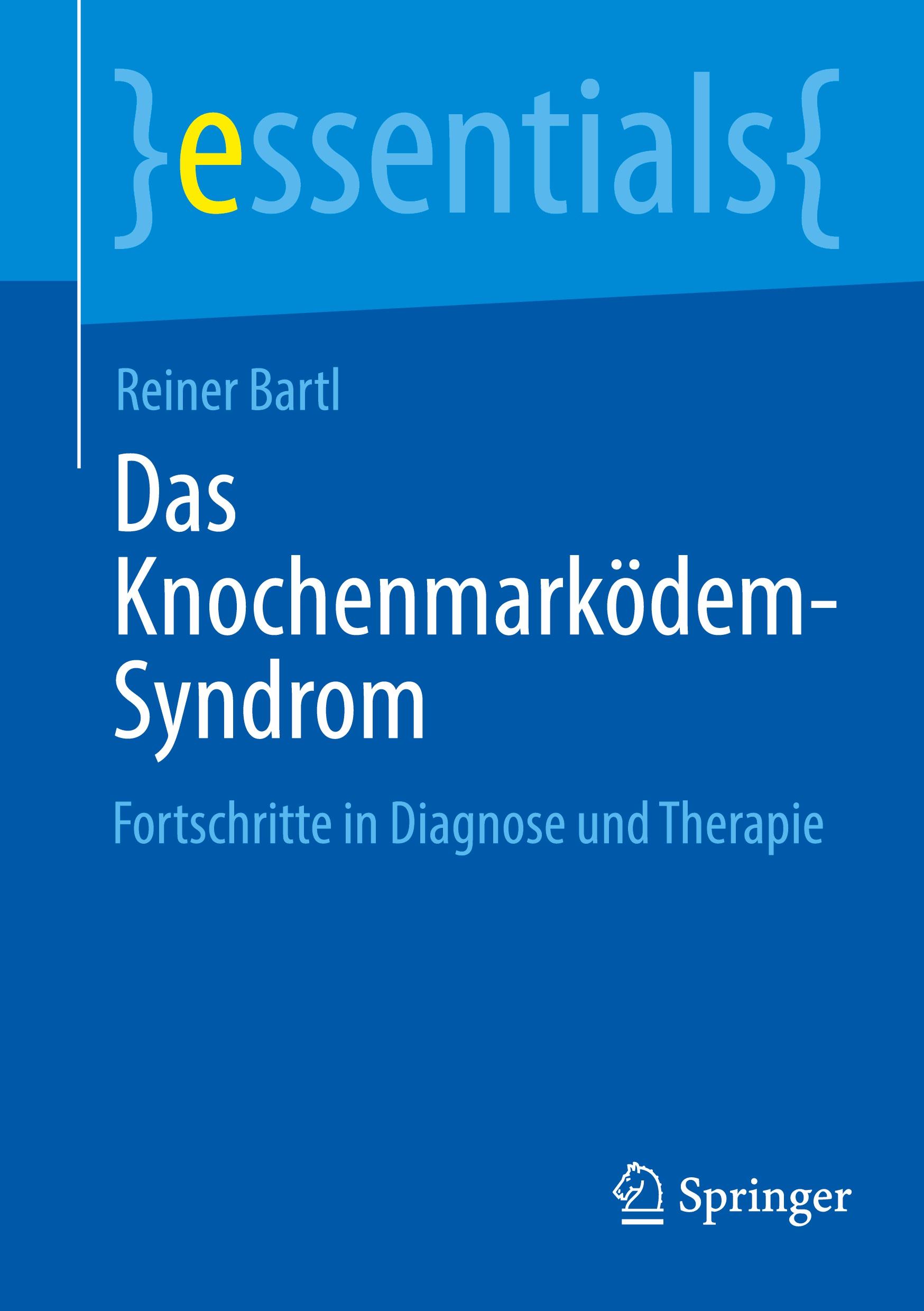 Vorderes Coverbild Das Knochenmarködem-Syndrom
