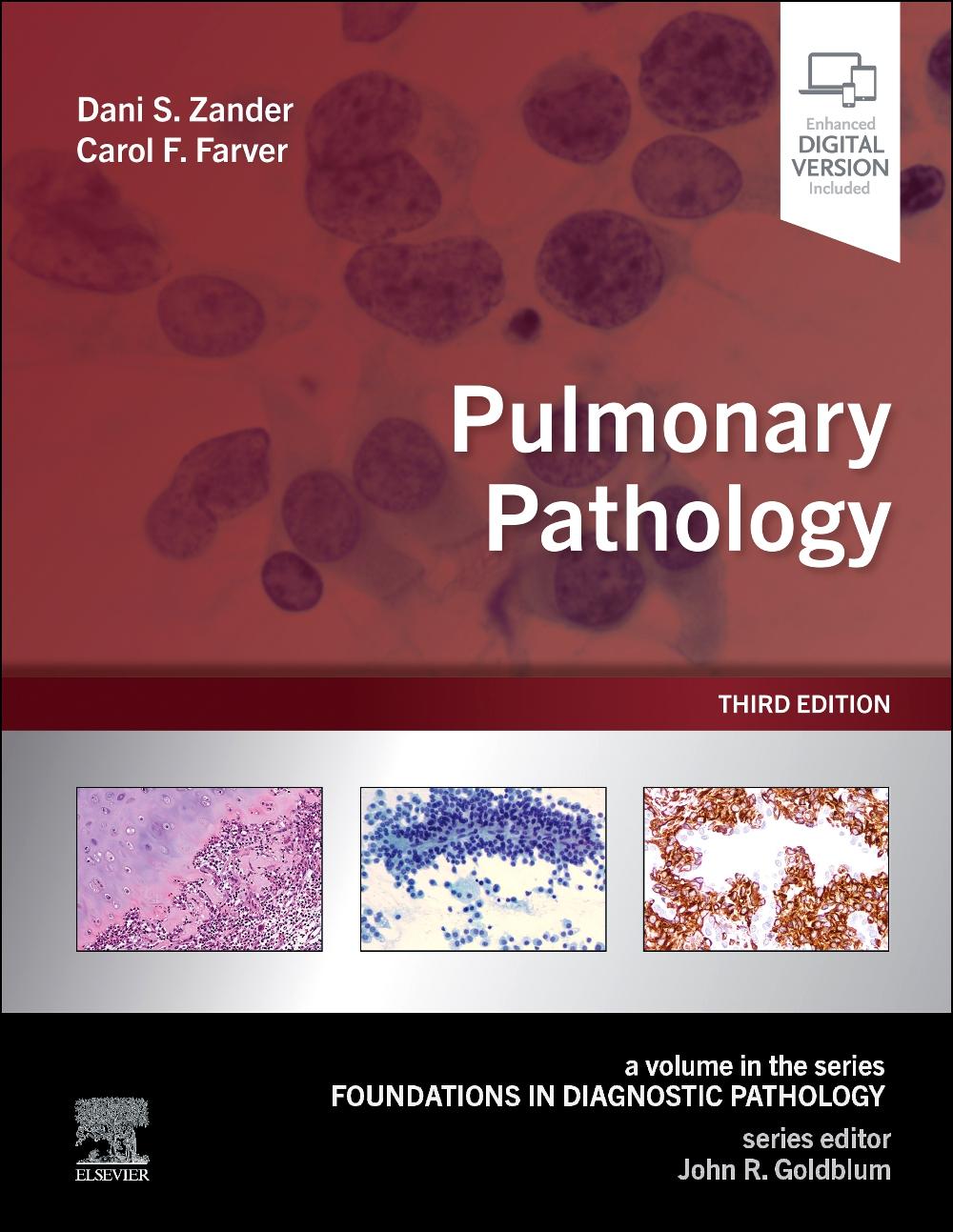 Vorderes Coverbild Pulmonary Pathology