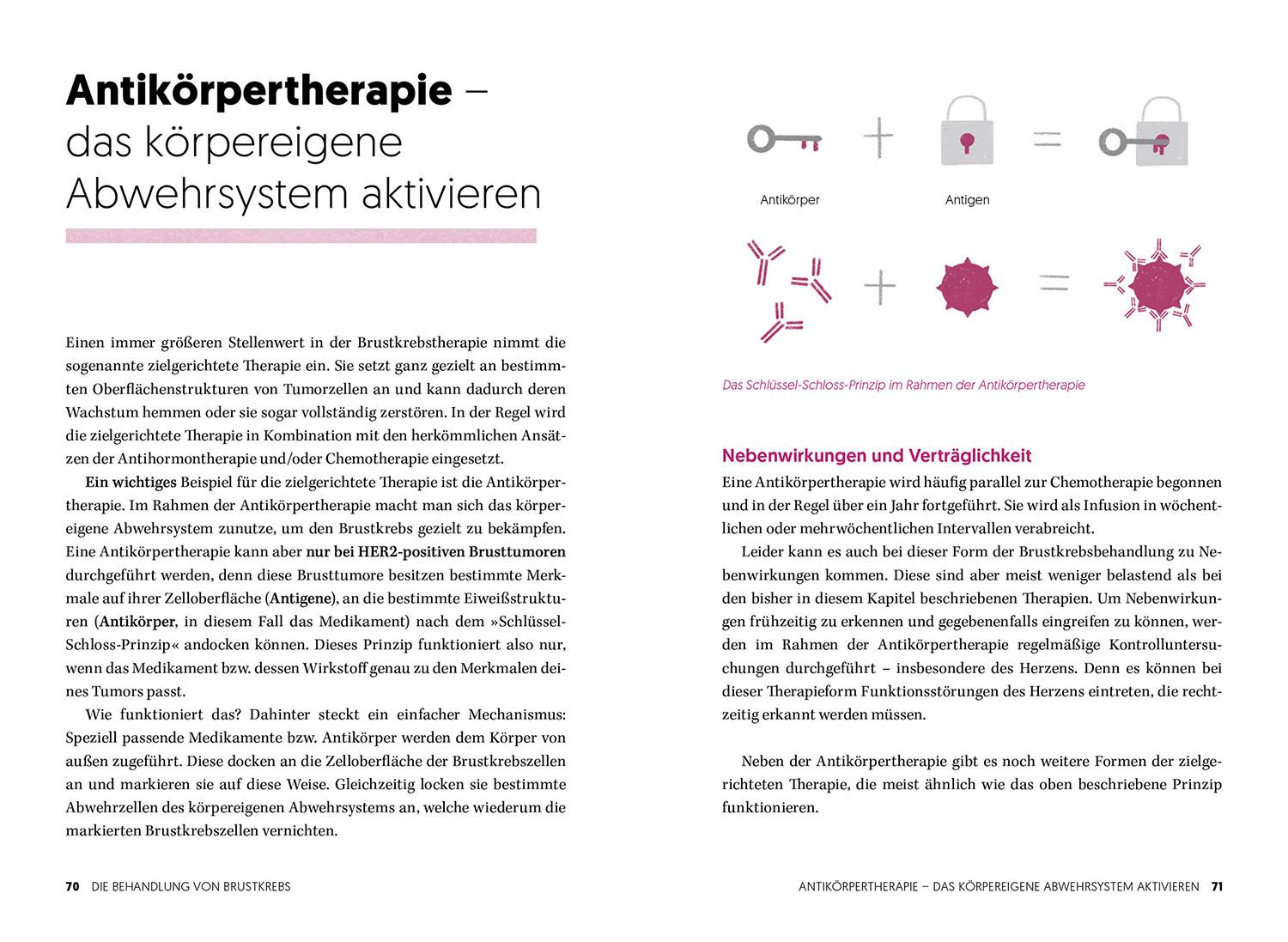 Beispielinhalt (Bild) Diagnose Brustkrebs