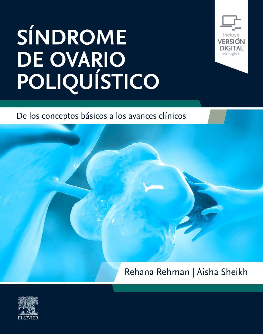 Vorderes Coverbild Síndrome de ovario poliquístico