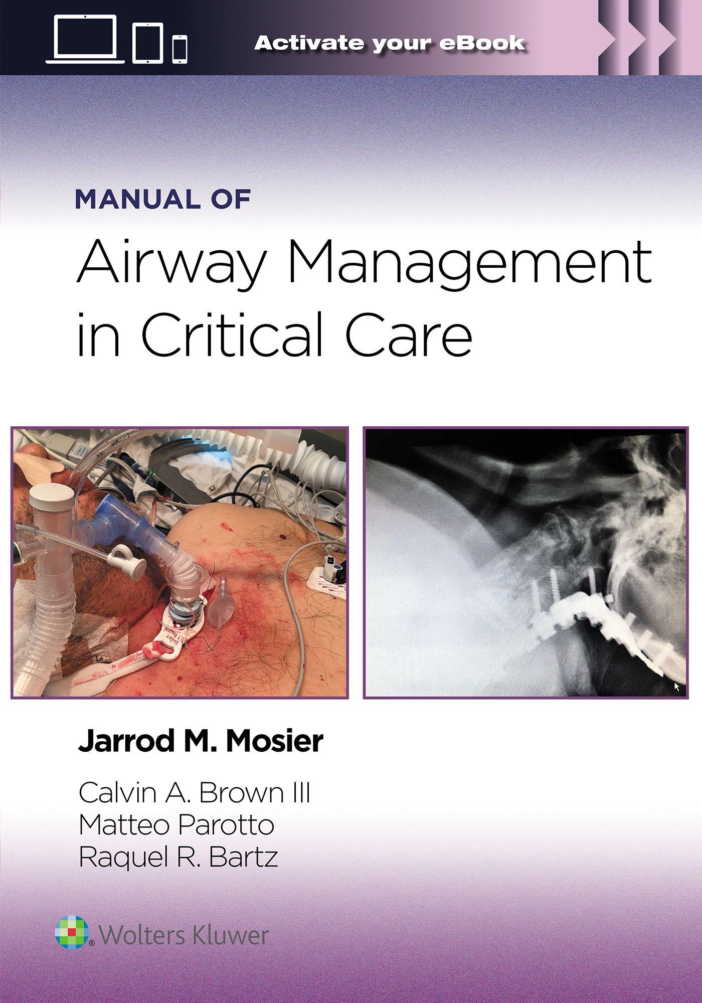 Vorderes Coverbild Manual of Airway Management in Critical Care: Print + eBook with Multimedia