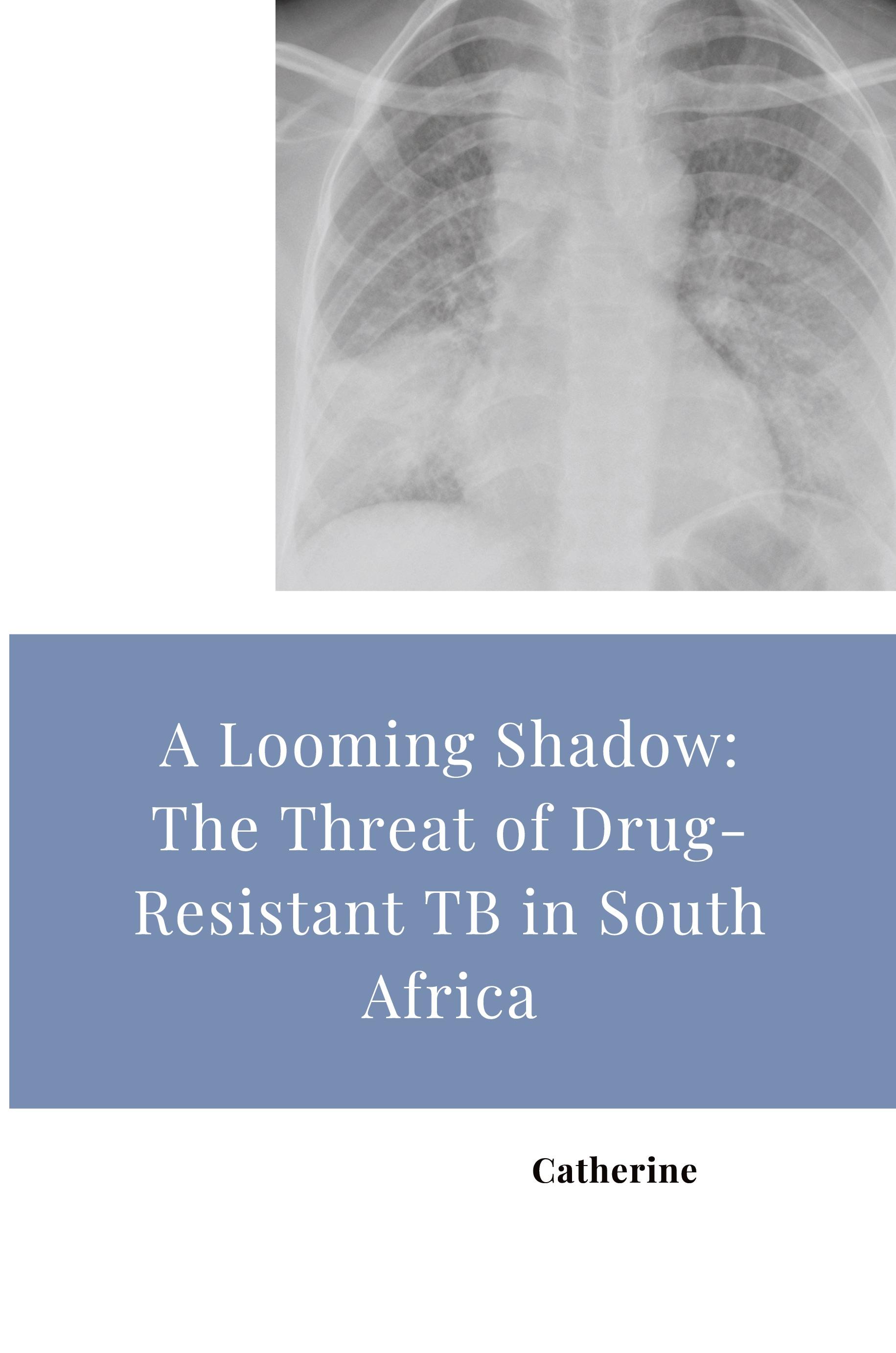 Vorderes Coverbild A Looming Shadow: The Threat of Drug-Resistant TB in South Africa
