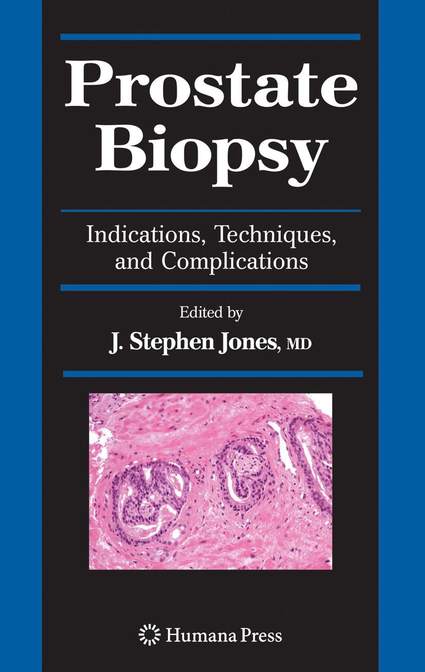 Vorderes Coverbild Prostate Biopsy