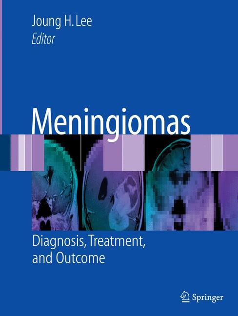 Vorderes Coverbild Meningiomas