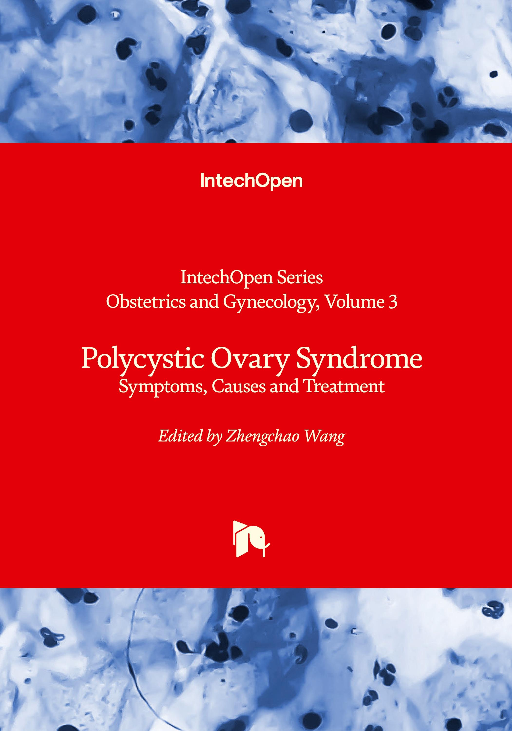 Vorderes Coverbild Polycystic Ovary Syndrome