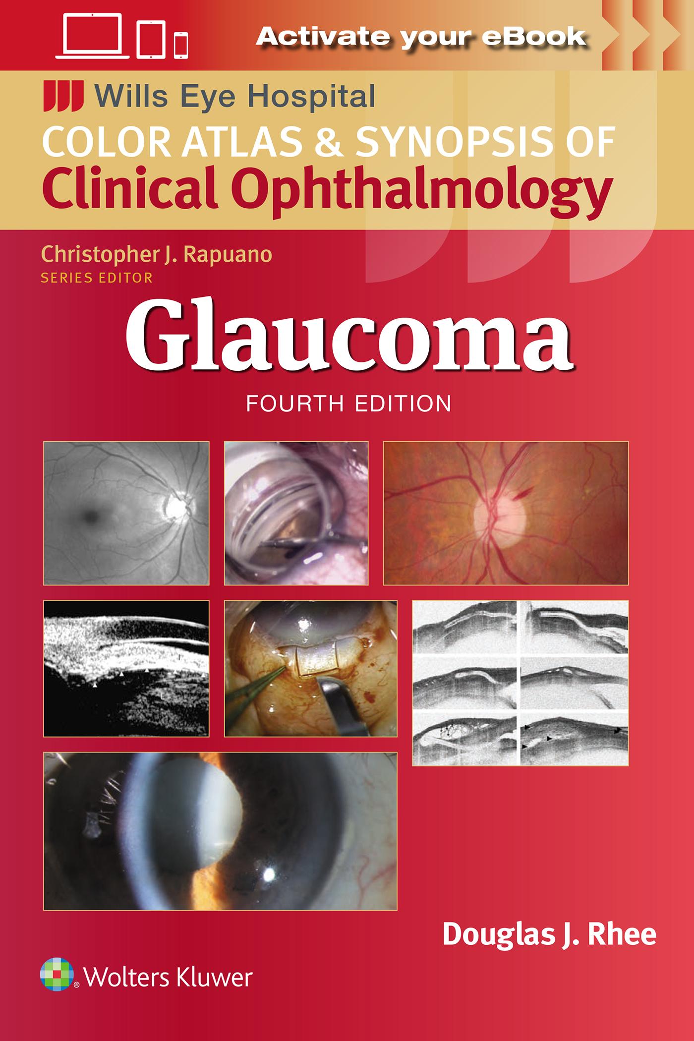 Vorderes Coverbild Glaucoma