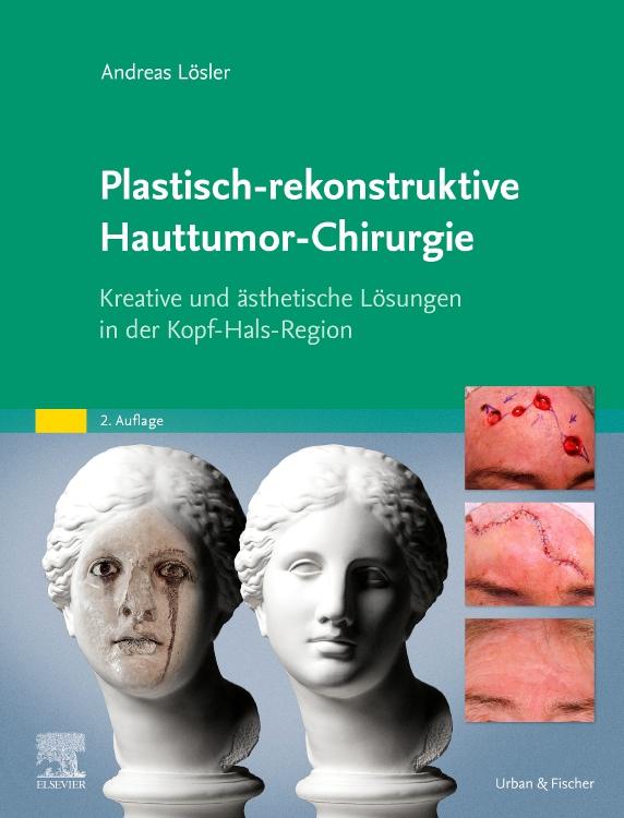 Vorderes Coverbild Plastisch-rekonstruktive Hauttumor-Chirurgie