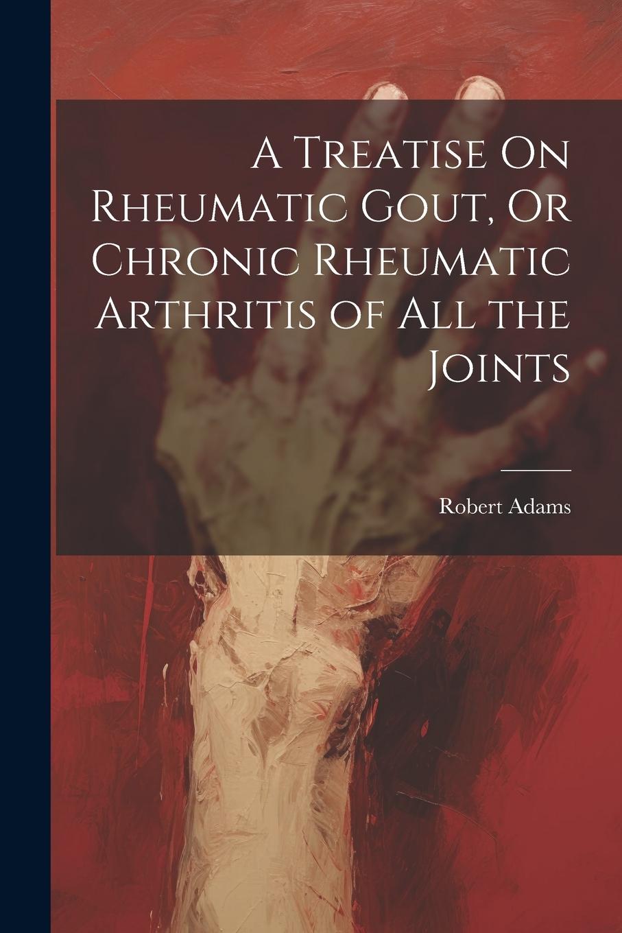 Vorderes Coverbild A Treatise On Rheumatic Gout, Or Chronic Rheumatic Arthritis of All the Joints