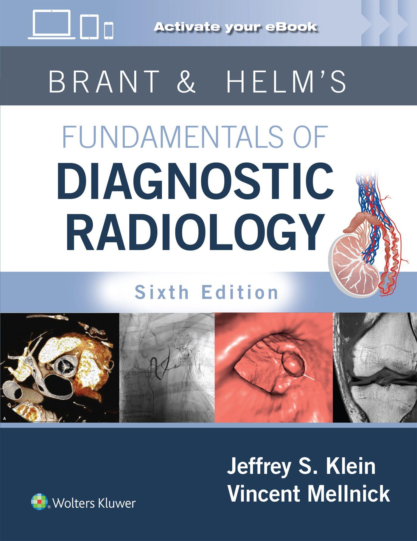 Vorderes Coverbild Brant & Helms' Fundamentals of Diagnostic Radiology: Print + eBook with Multimedia