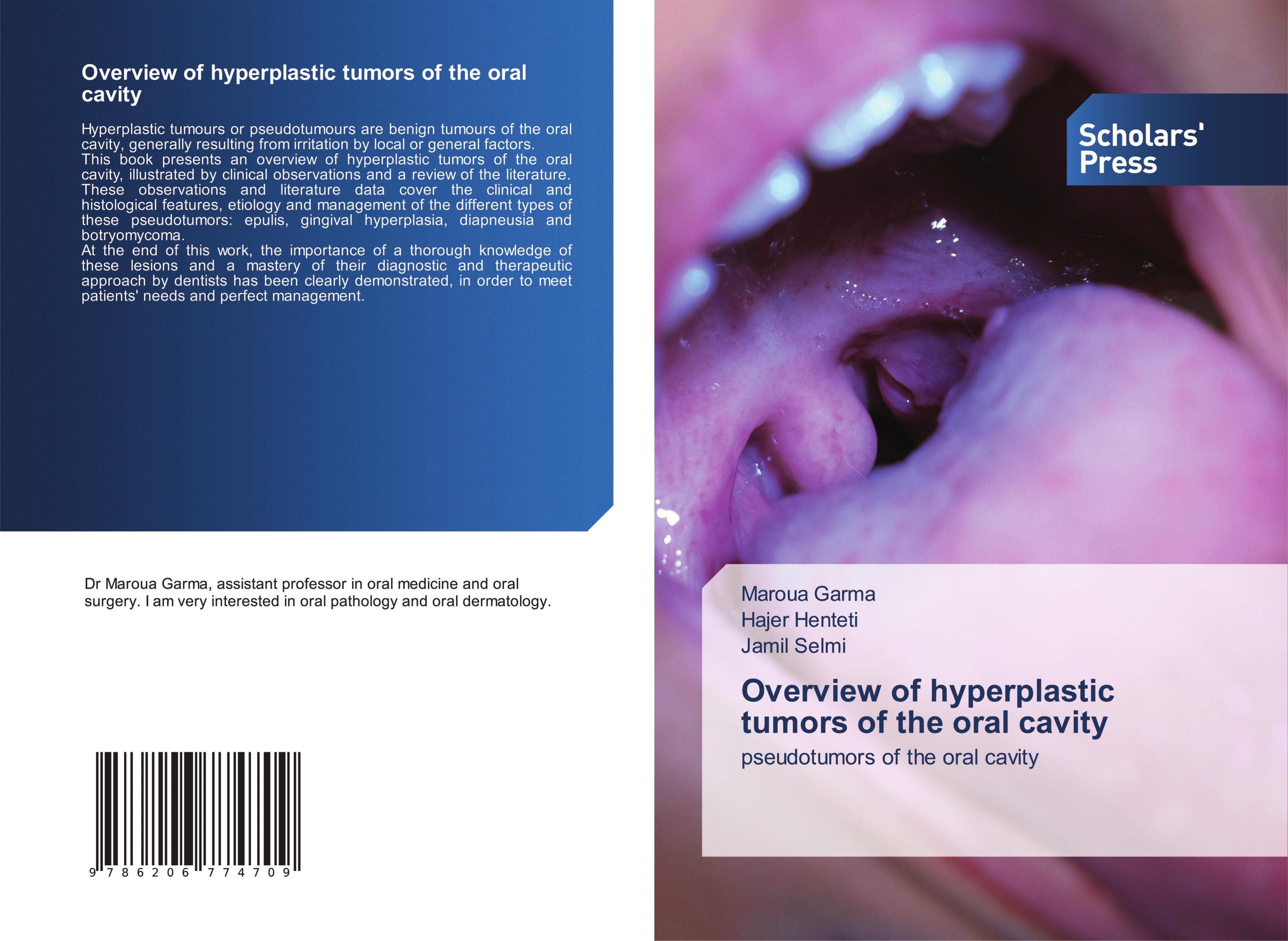 Vorderes Coverbild Overview of hyperplastic tumors of the oral cavity