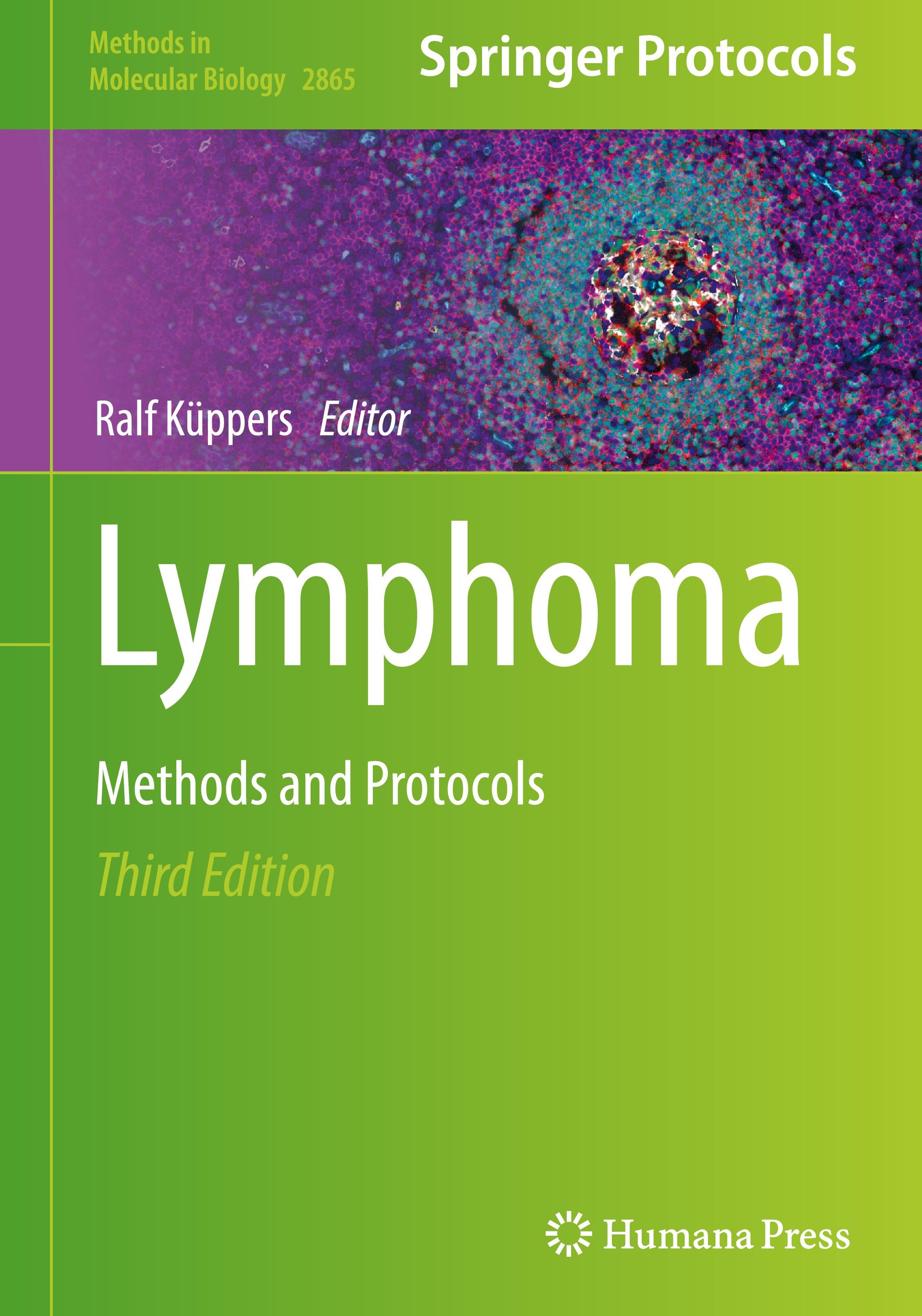 Vorderes Coverbild Lymphoma