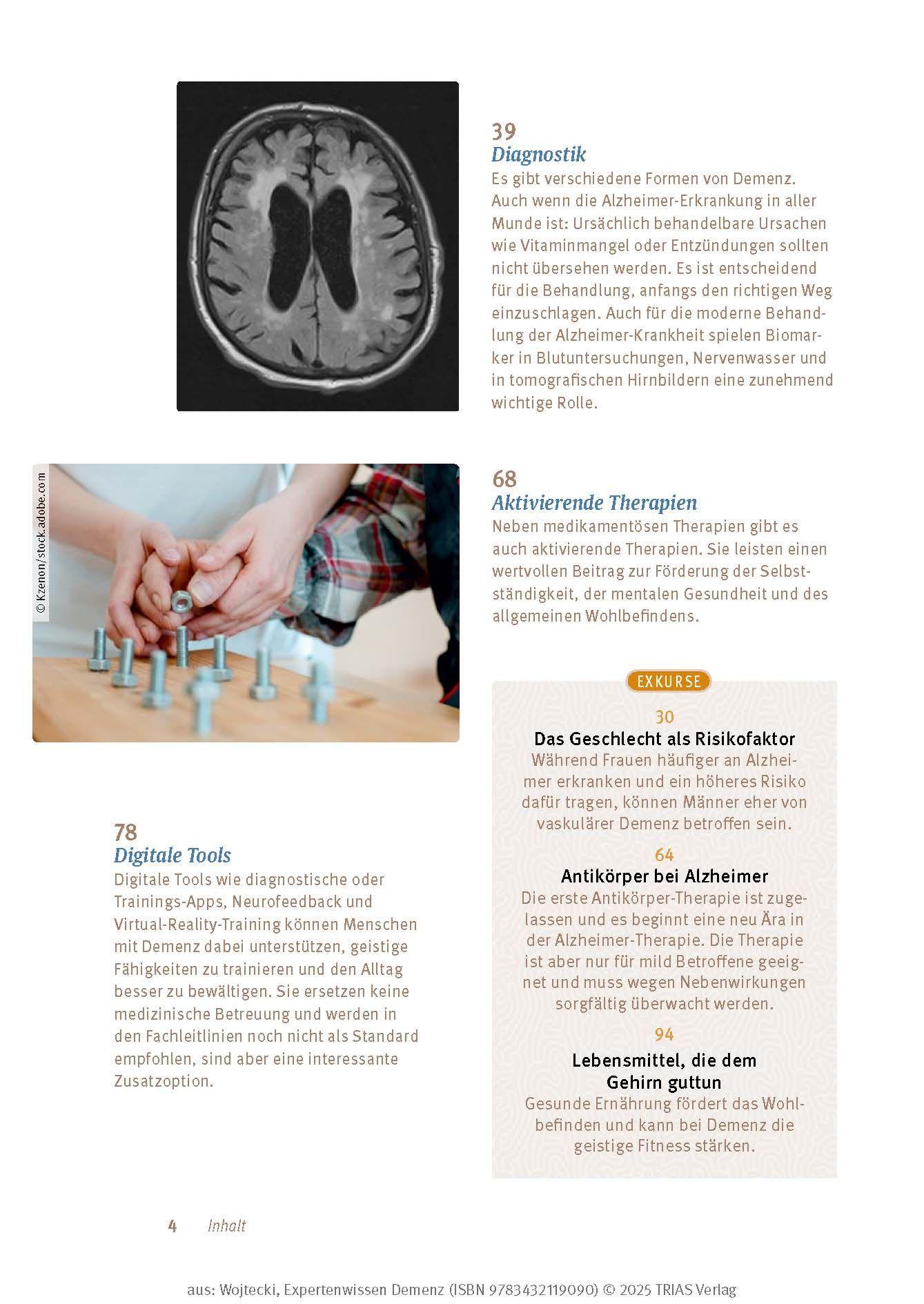 Beispielinhalt (Bild) Expertenwissen: Demenz