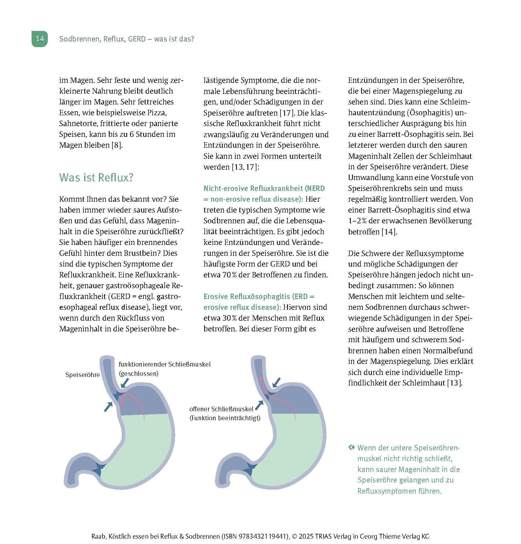 Beispielinhalt (Bild) Köstlich essen Reflux und Sodbrennen