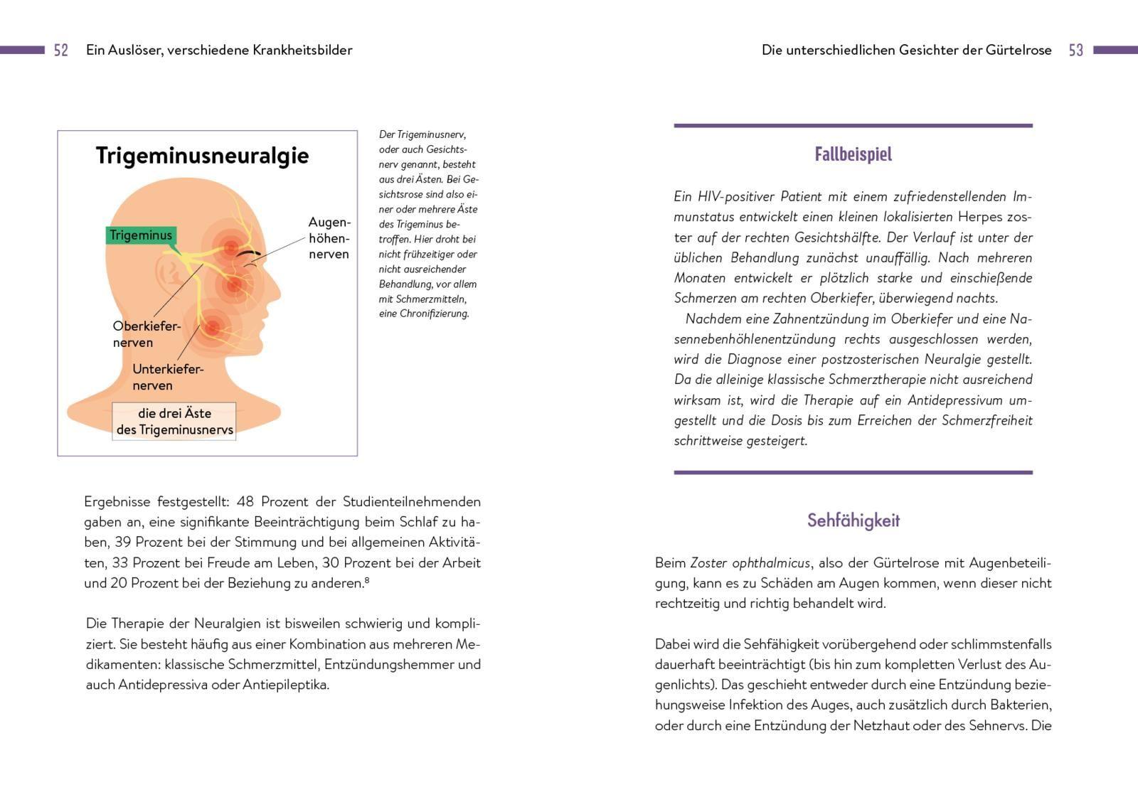 Beispielinhalt (Bild) Gürtelrose