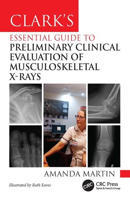 Vorderes Coverbild Clark's Essential Guide to Preliminary Clinical Evaluation of Musculoskeletal X-Rays