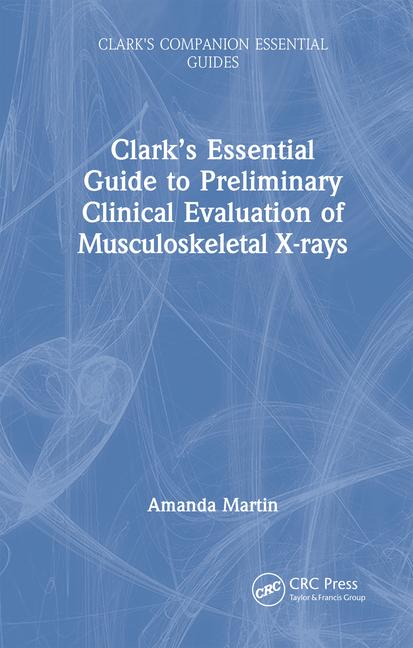 Vorderes Coverbild Clark's Essential Guide to Preliminary Clinical Evaluation of Musculoskeletal X-Rays