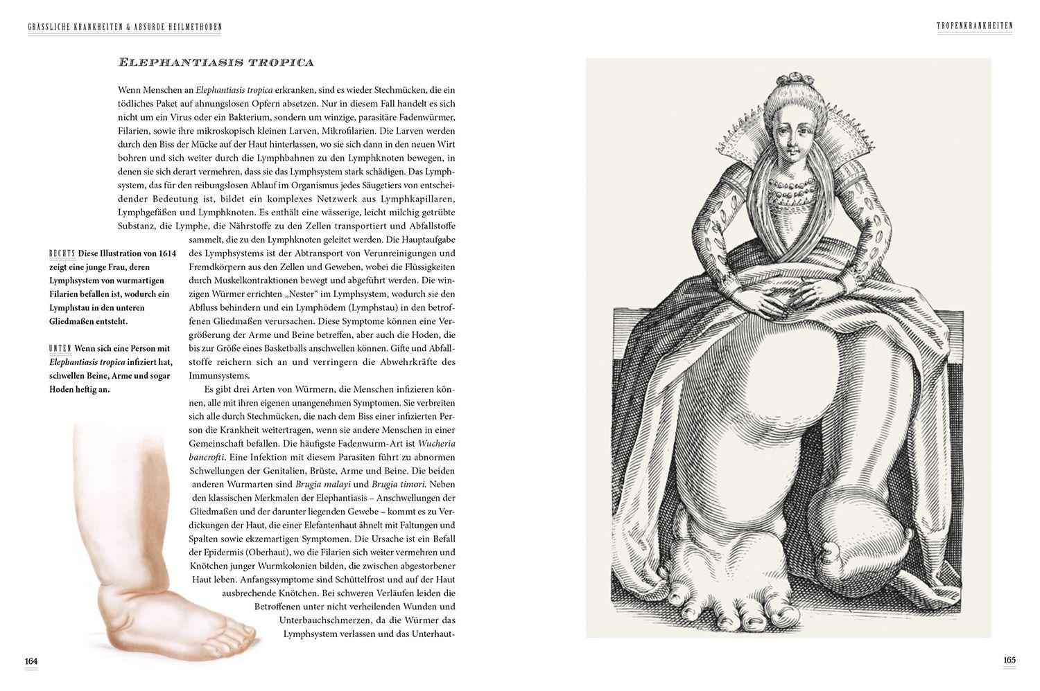 Beispielinhalt (Bild) Grässliche Krankheiten & Absurde Heilmethoden