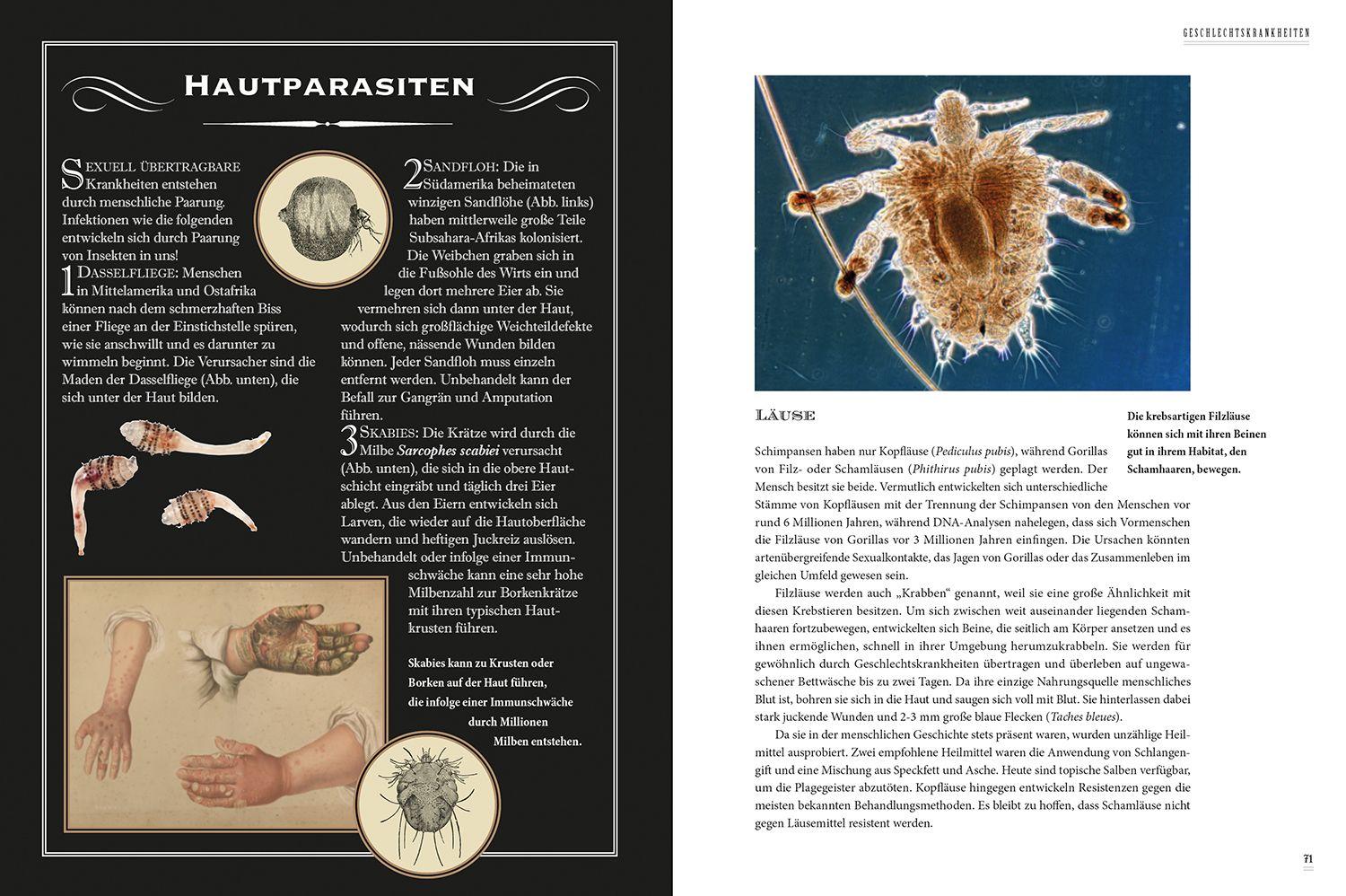 Beispielinhalt (Bild) Grässliche Krankheiten & Absurde Heilmethoden