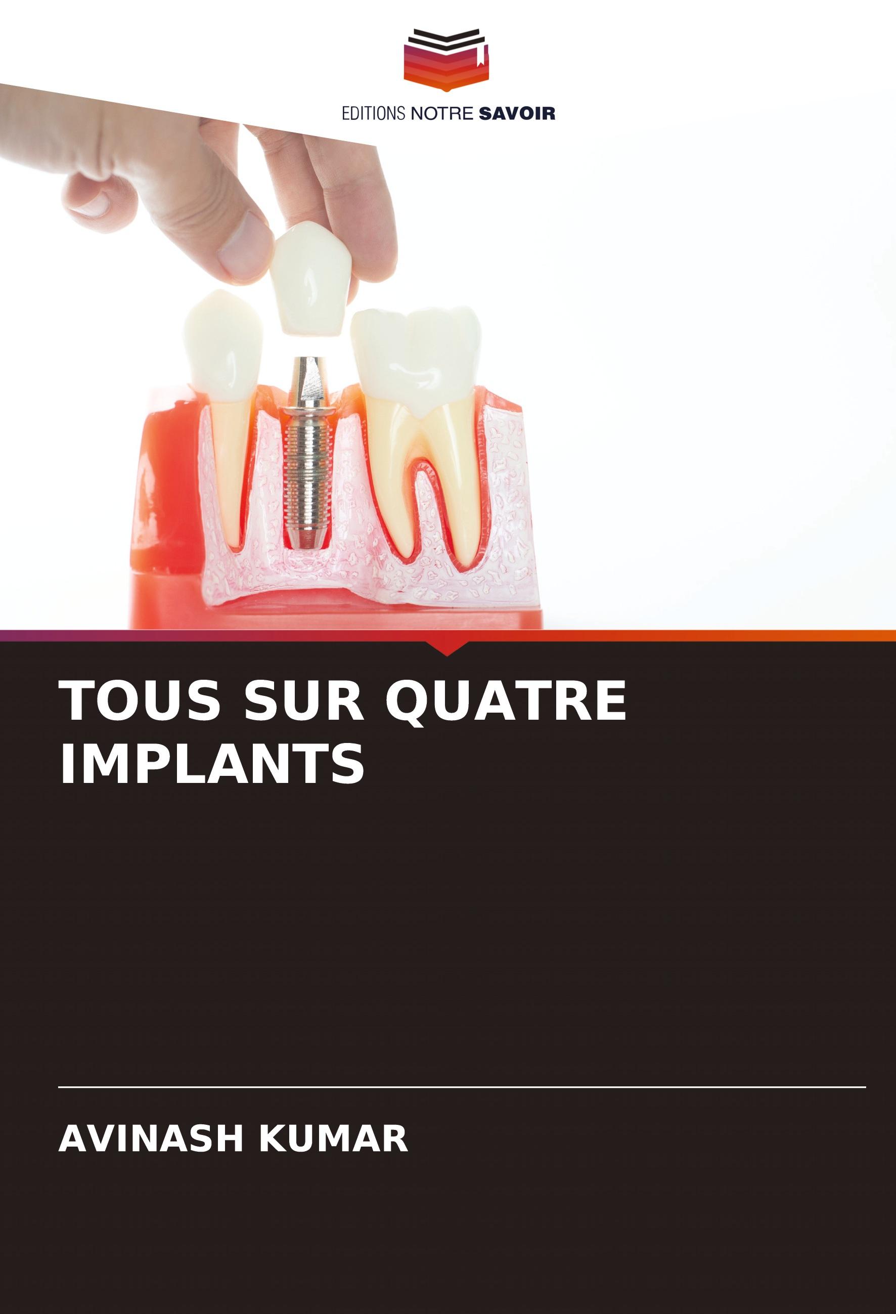 Vorderes Coverbild TOUS SUR QUATRE IMPLANTS