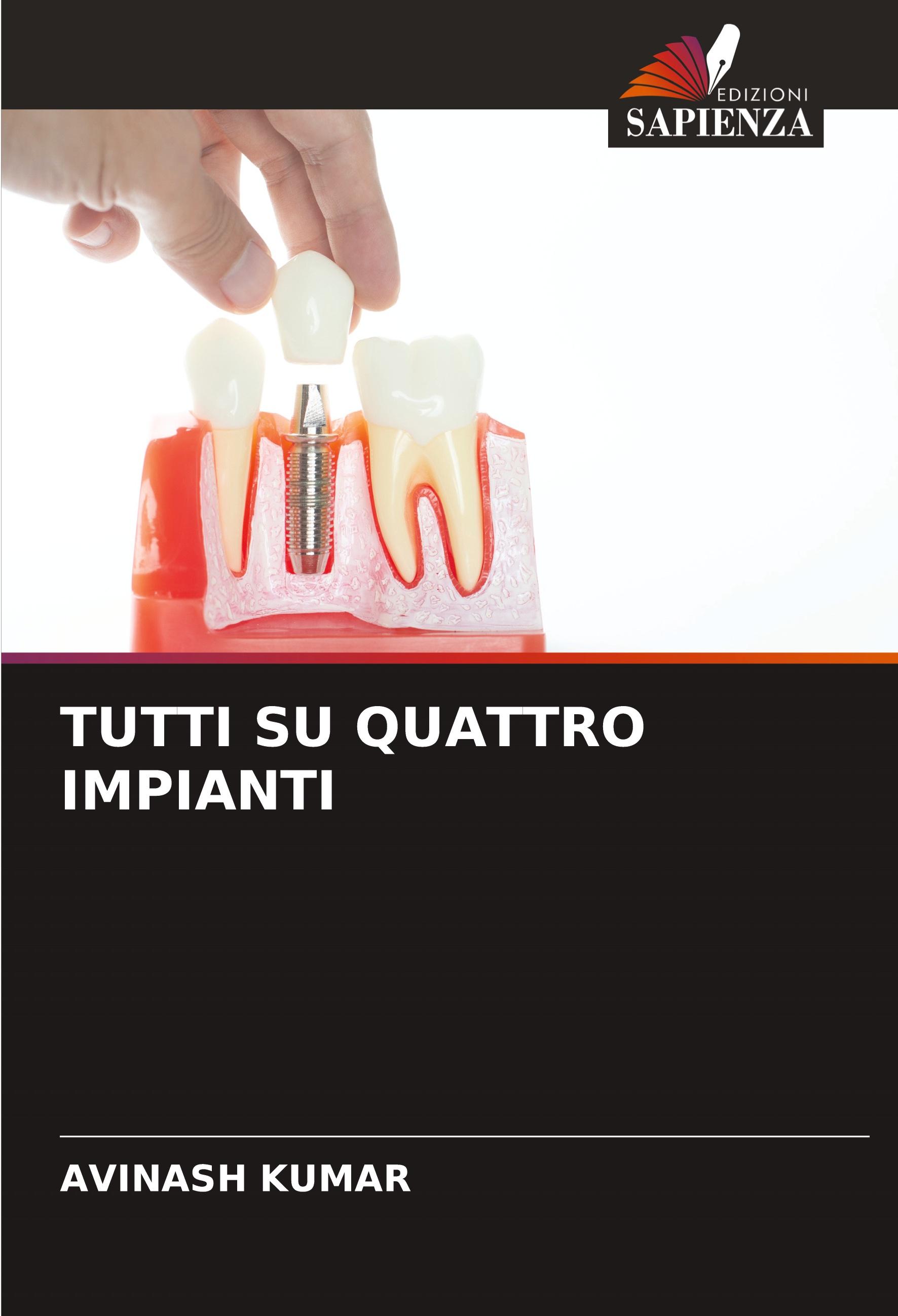 Vorderes Coverbild TUTTI SU QUATTRO IMPIANTI
