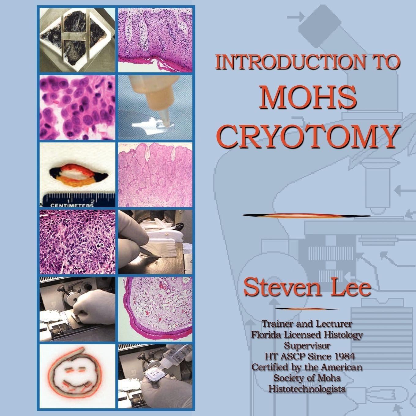 Vorderes Coverbild Introduction to MOHS Cryotomy