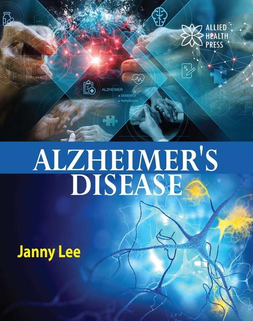 Vorderes Coverbild Alzheimer's Disease