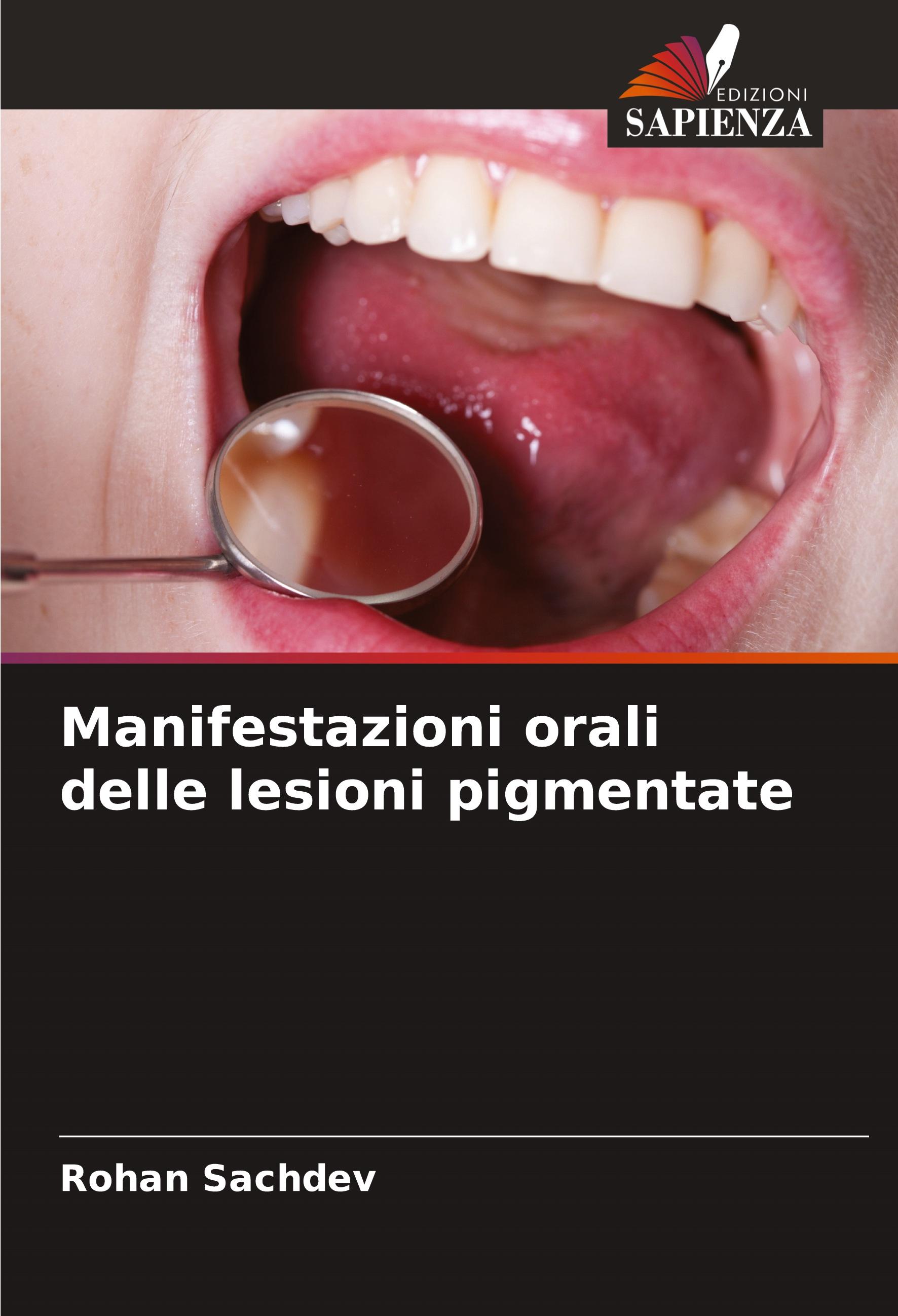 Vorderes Coverbild Manifestazioni orali delle lesioni pigmentate