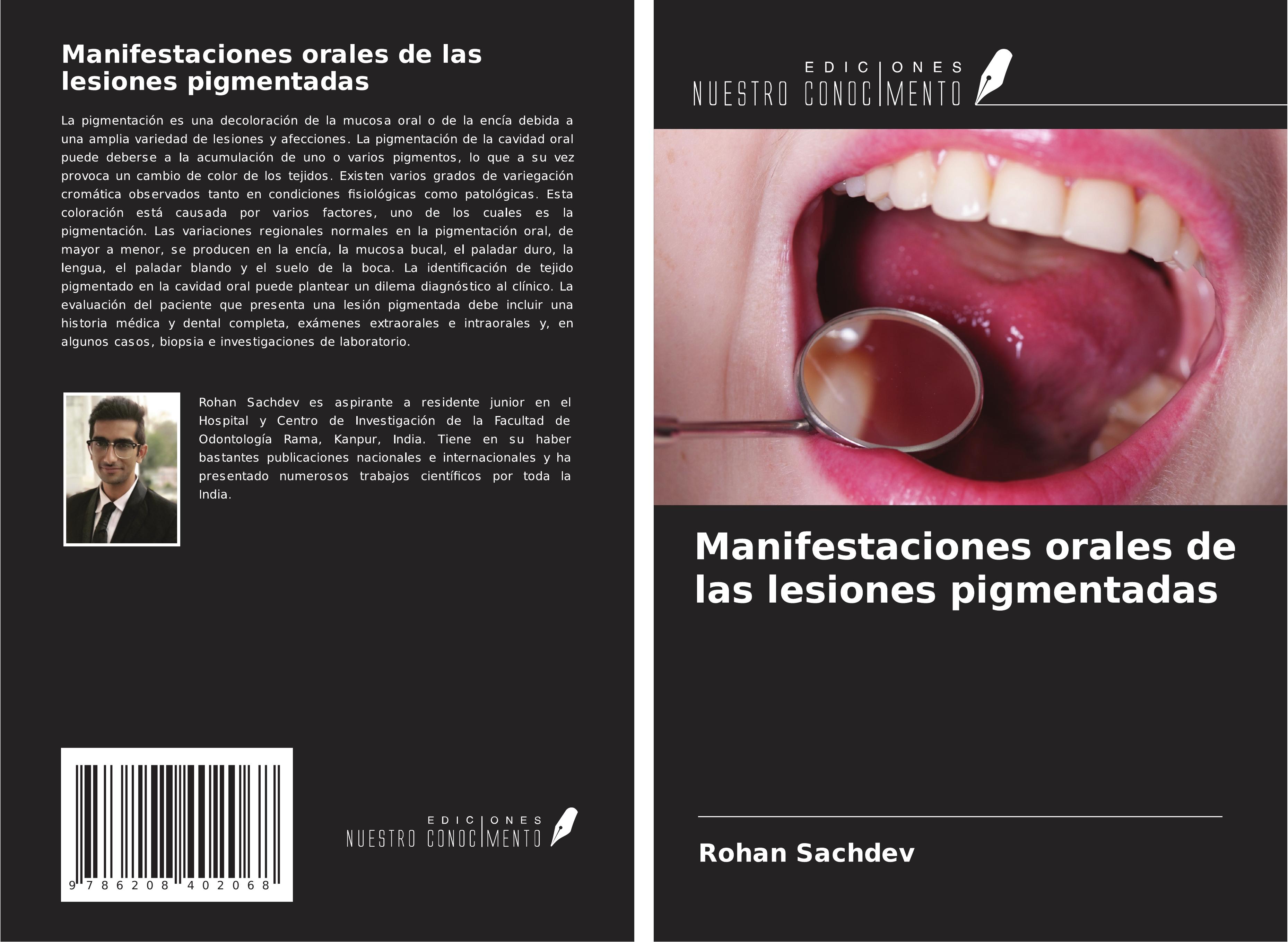 Vorderes Coverbild Manifestaciones orales de las lesiones pigmentadas