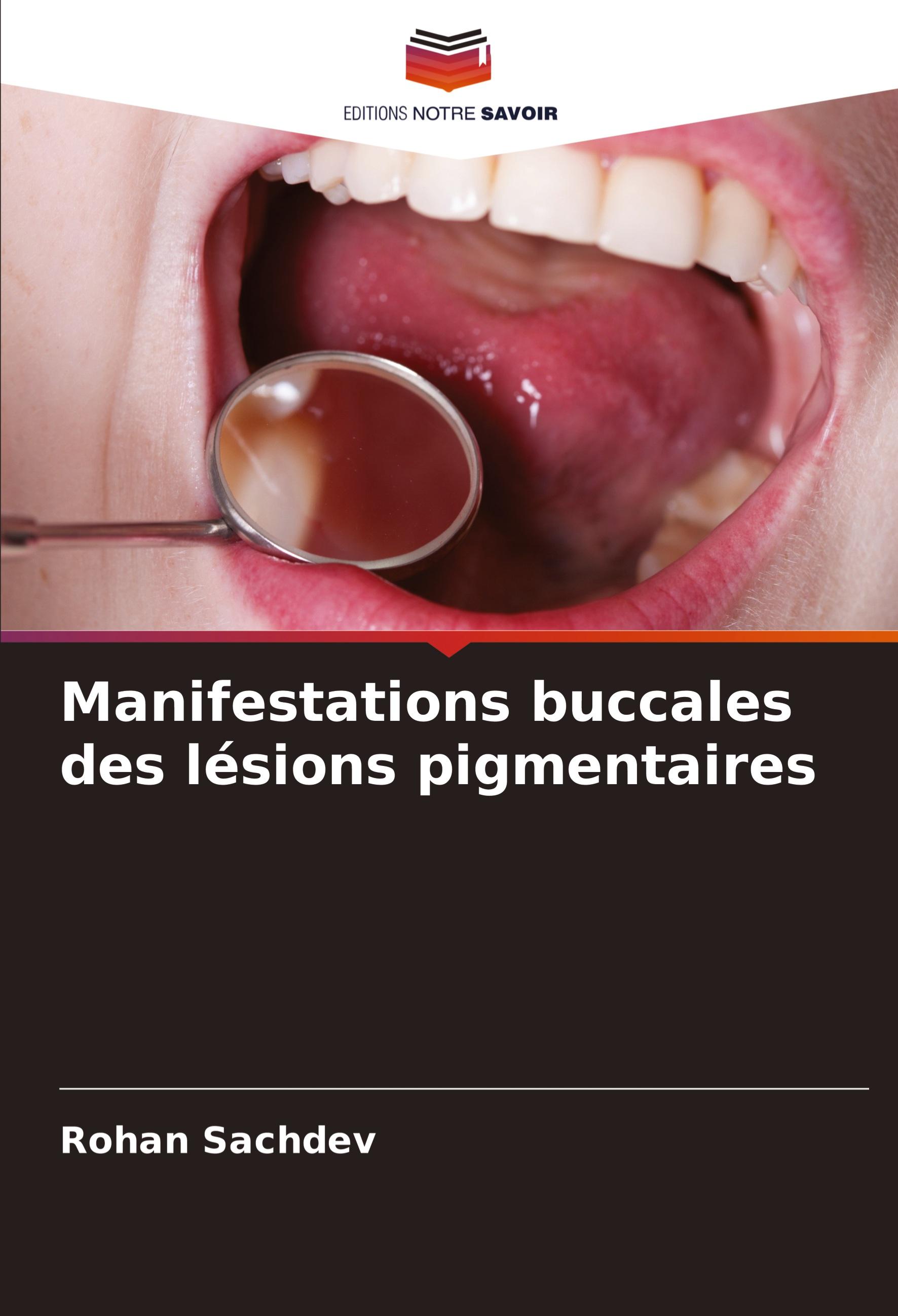 Vorderes Coverbild Manifestations buccales des lésions pigmentaires