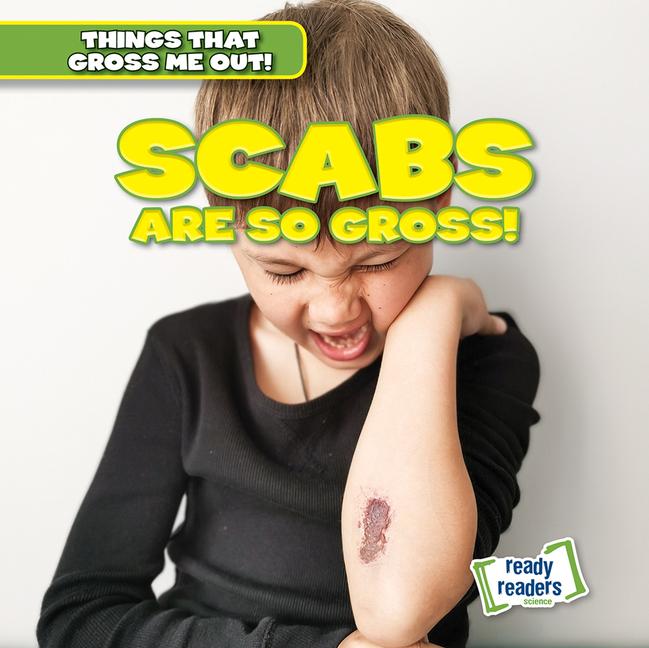 Vorderes Coverbild Scabs Are So Gross!