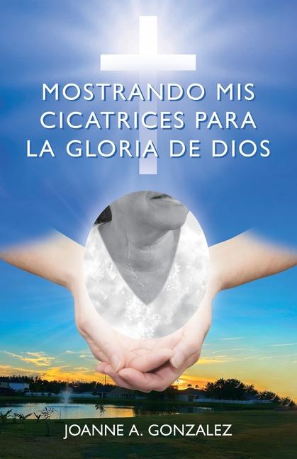 Vorderes Coverbild Mostrando mis cicatrices para la Gloria de Dios