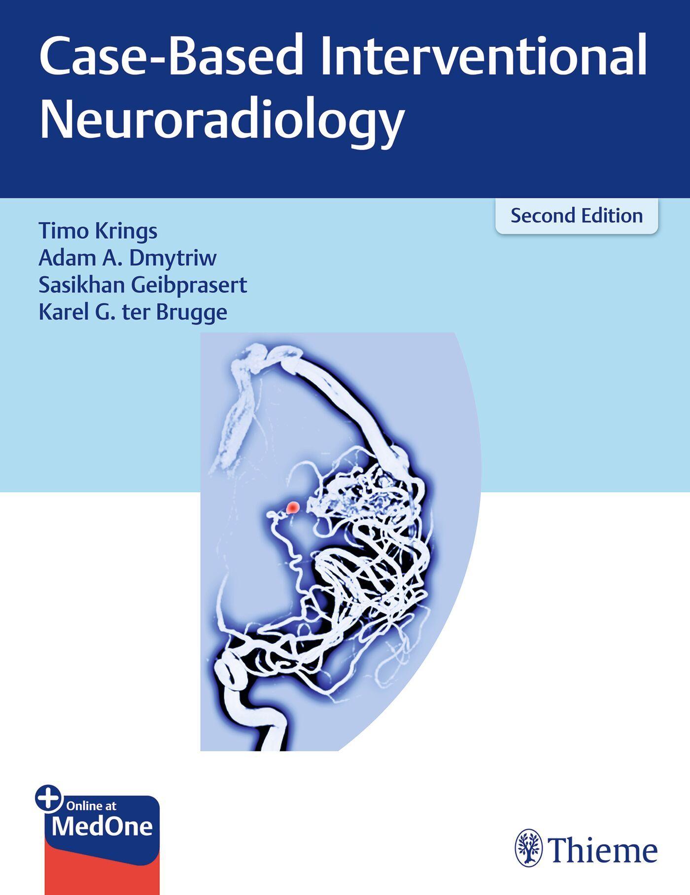Vorderes Coverbild Case-Based Interventional Neuroradiology
