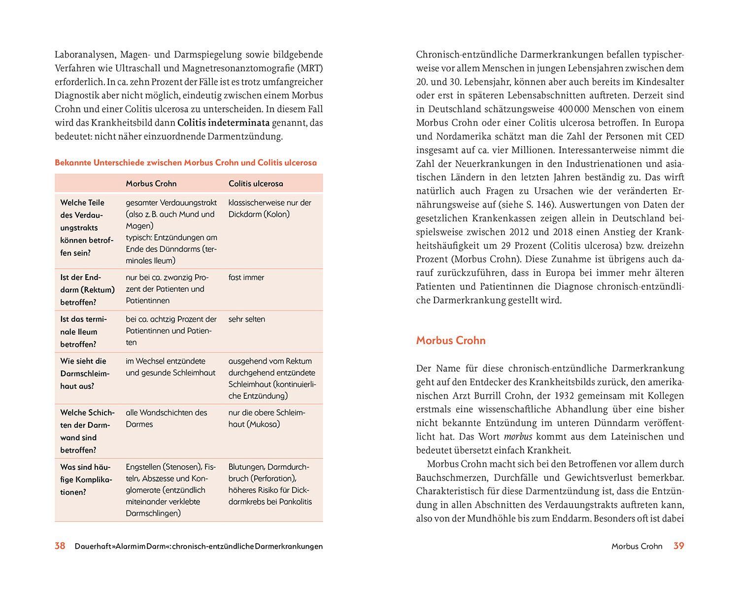 Beispielinhalt (Bild) Das hilft bei CED