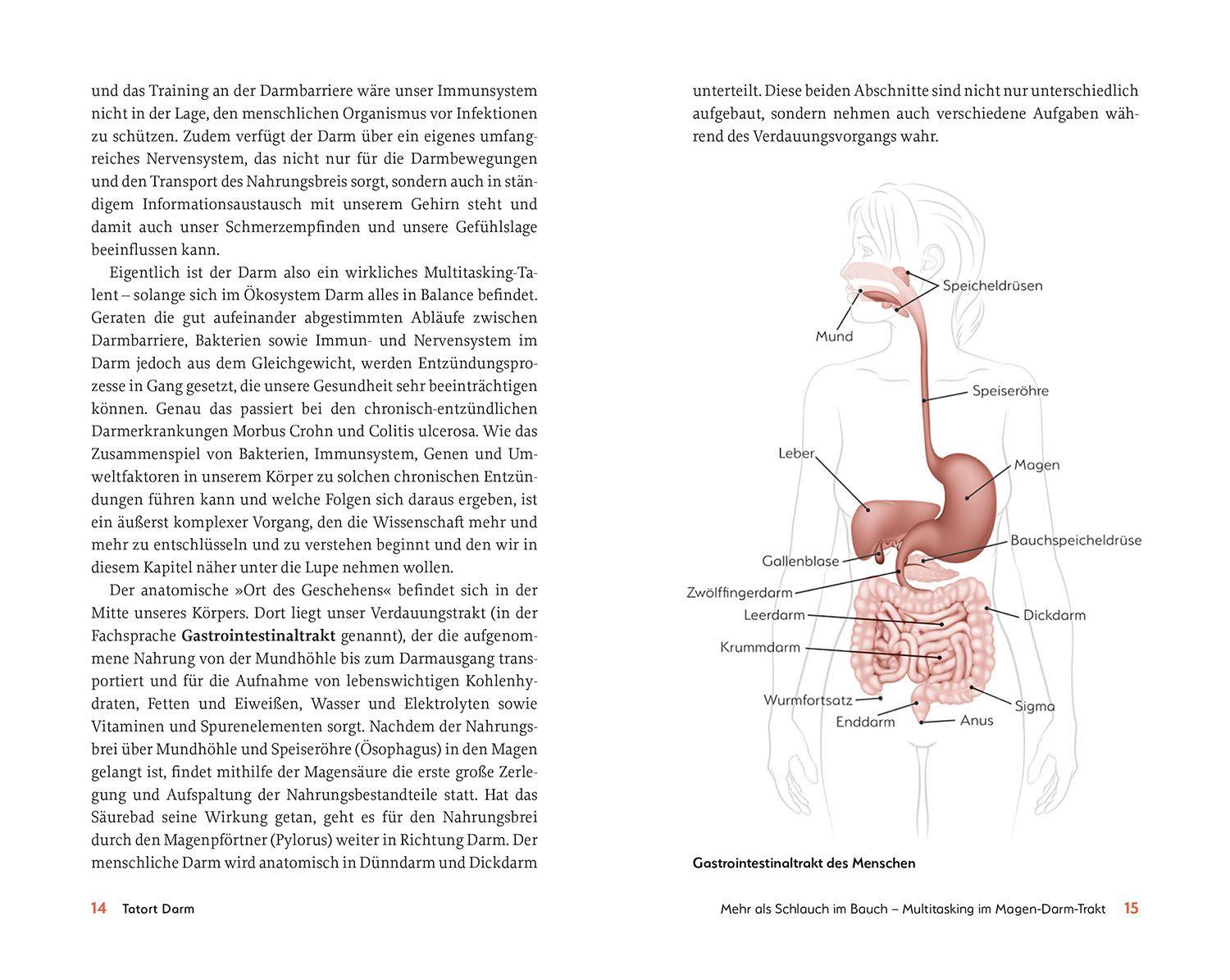 Beispielinhalt (Bild) Das hilft bei CED