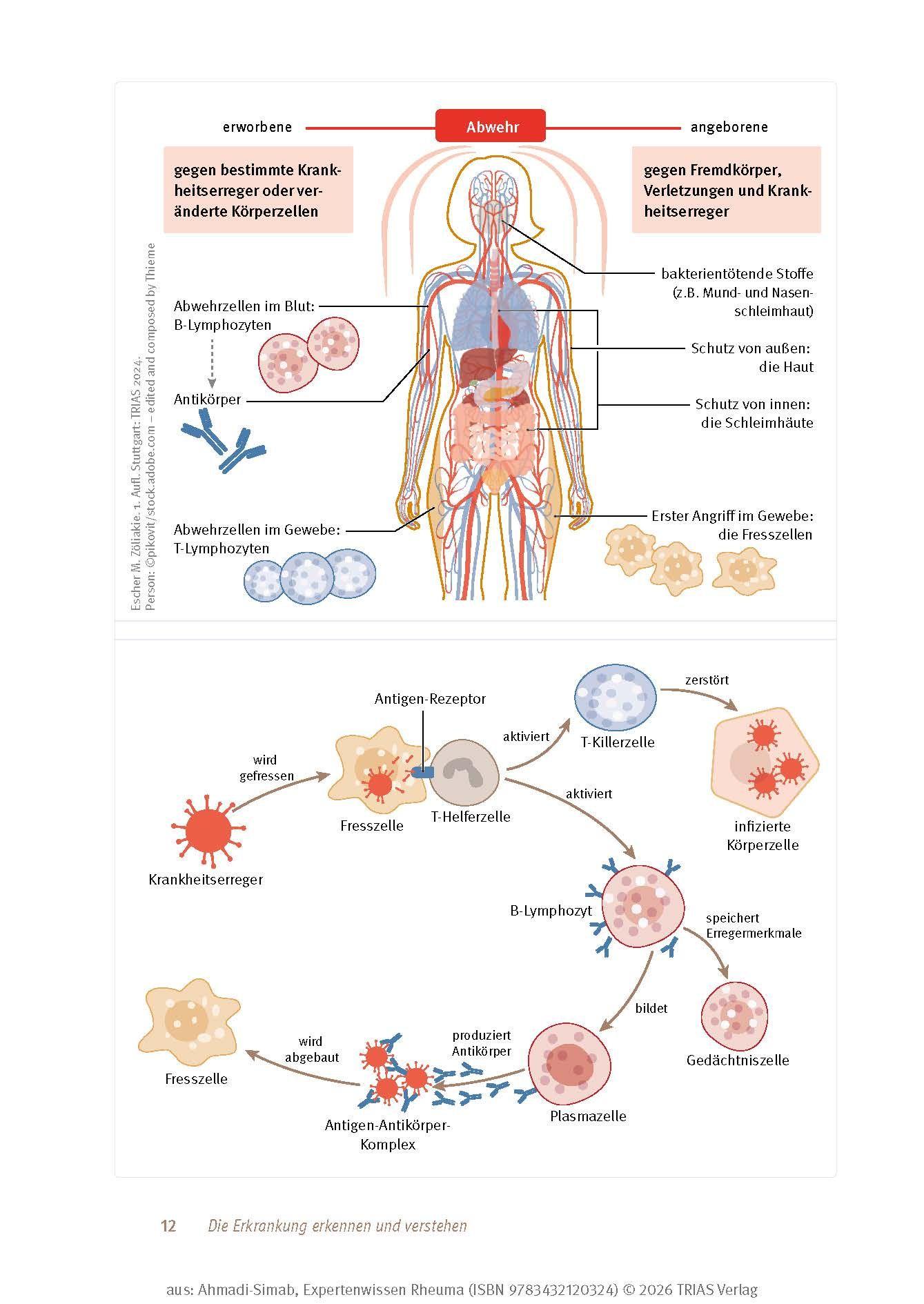 Beispielinhalt (Bild) Expertenwissen: Rheuma