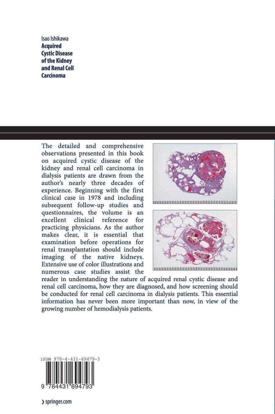Rückseitencover Acquired Cystic Disease of the Kidney and Renal Cell Carcinoma