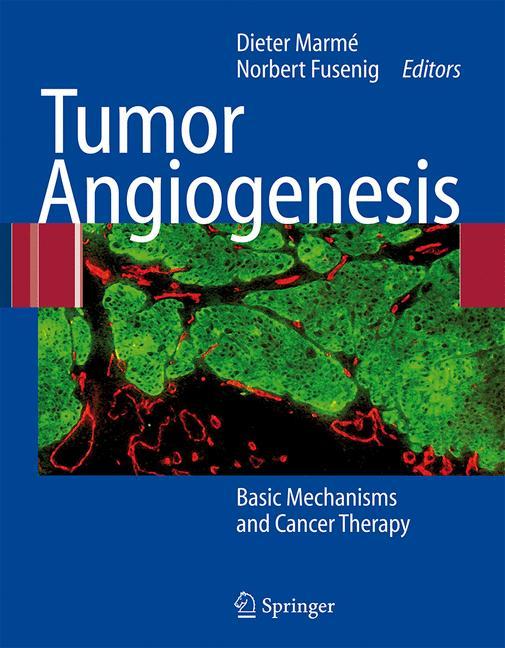 Vorderes Coverbild Tumor Angiogenesis