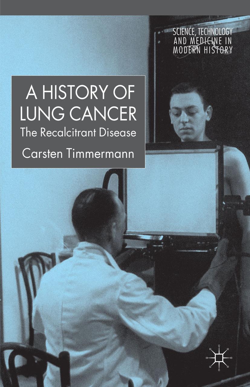 Vorderes Coverbild A History of Lung Cancer