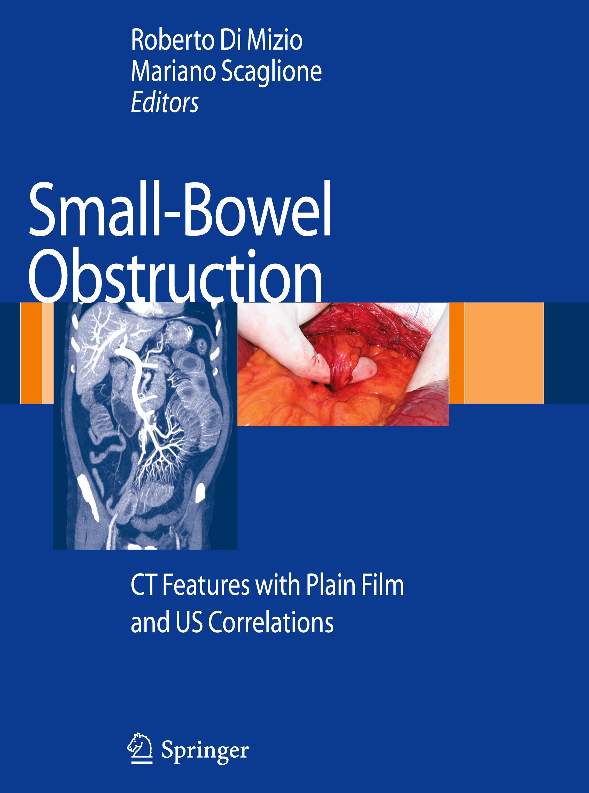 Vorderes Coverbild Small-Bowel Obstruction