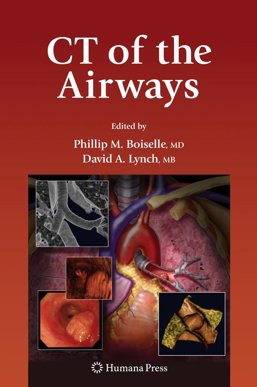Vorderes Coverbild CT of the Airways