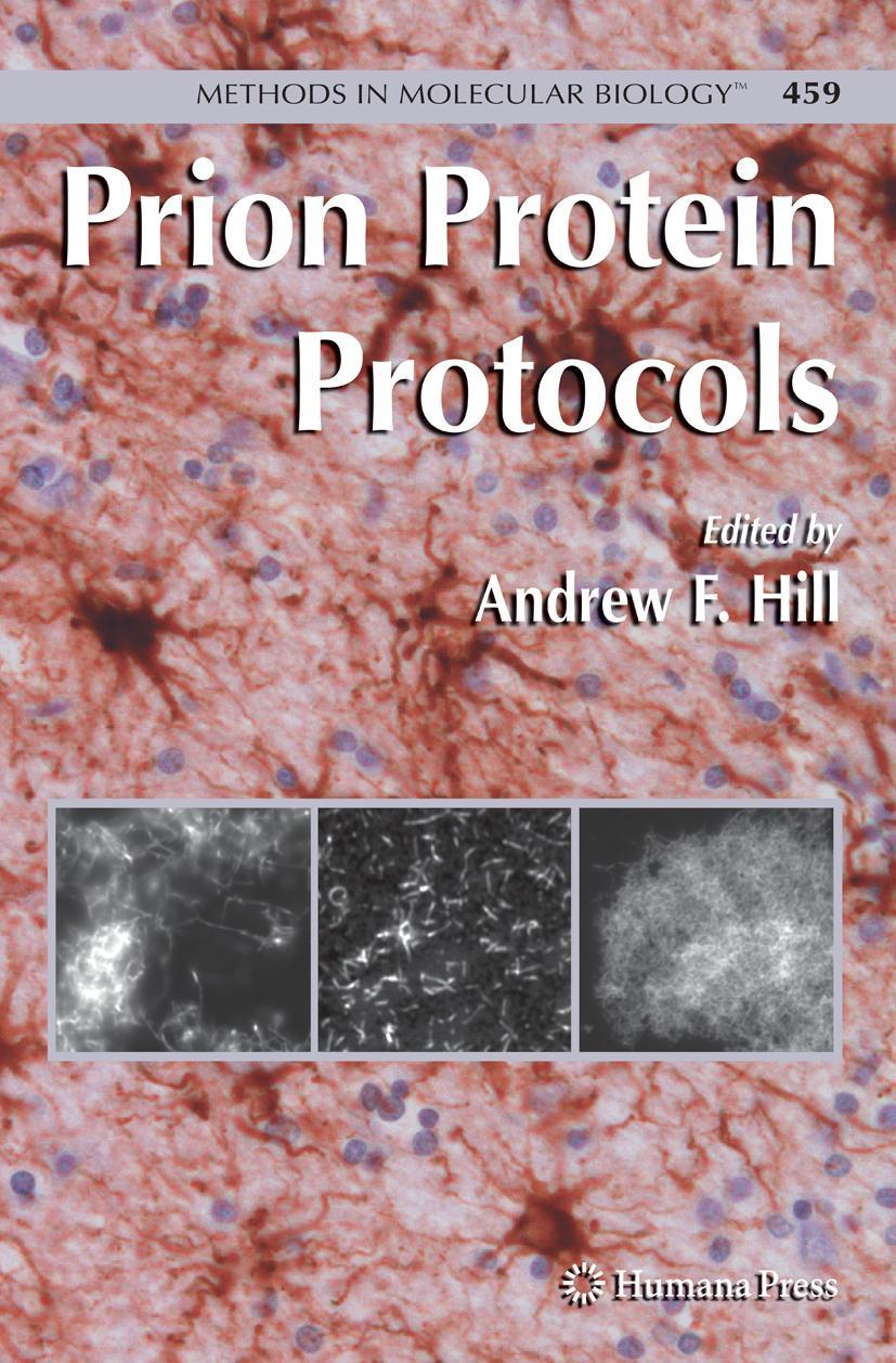 Vorderes Coverbild Prion Protein Protocols