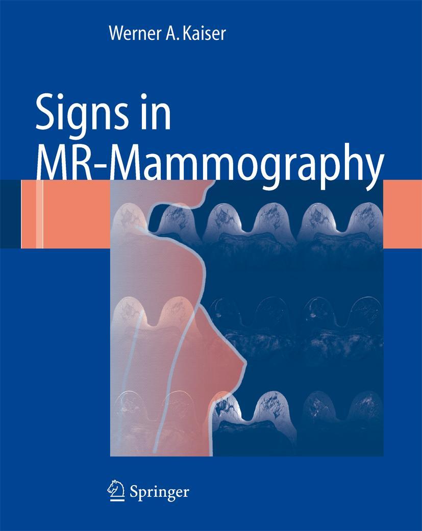 Vorderes Coverbild Signs in MR-Mammography