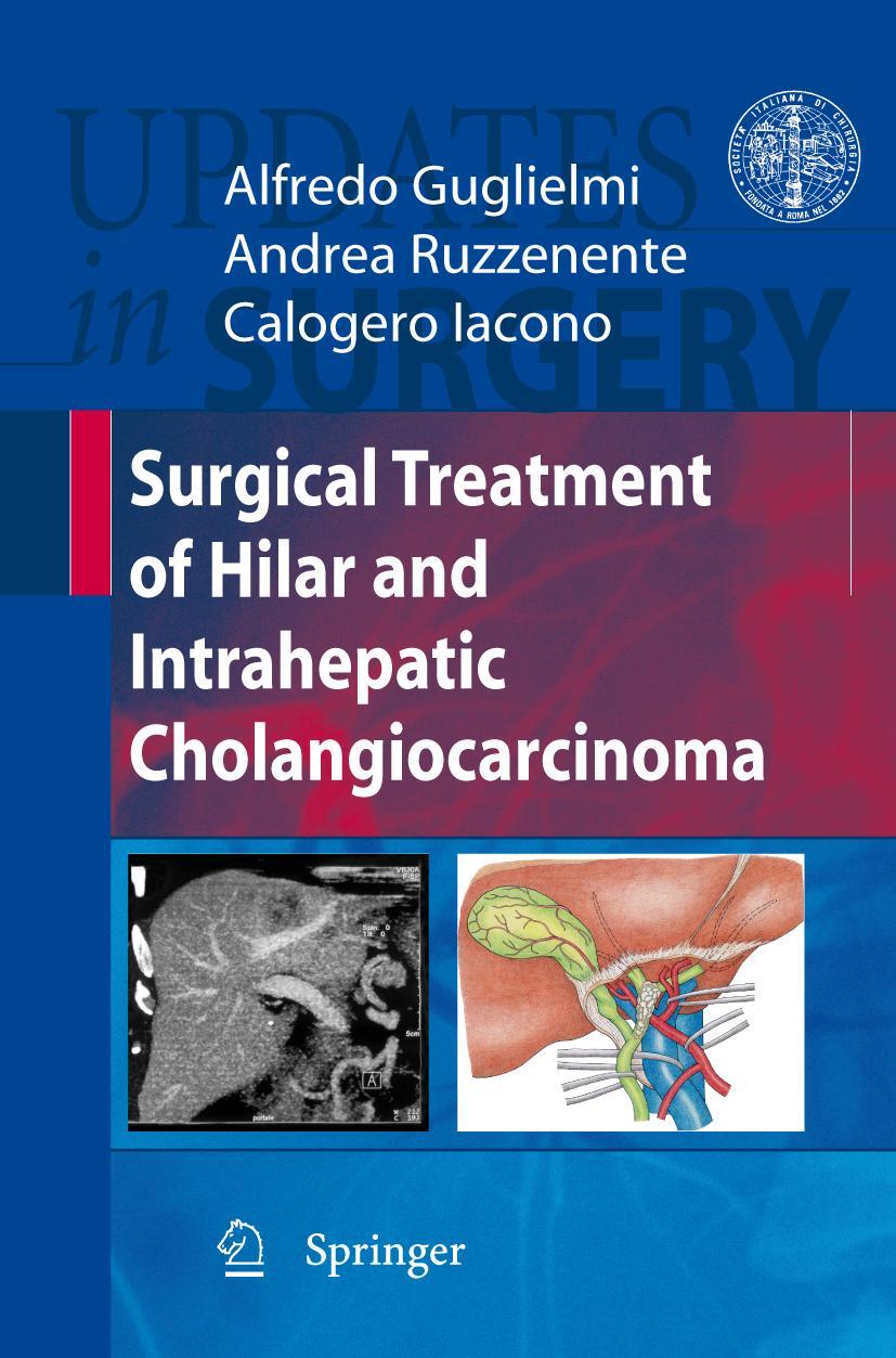 Vorderes Coverbild Surgical Treatment of Hilar and Intrahepatic Cholangiocarcinoma