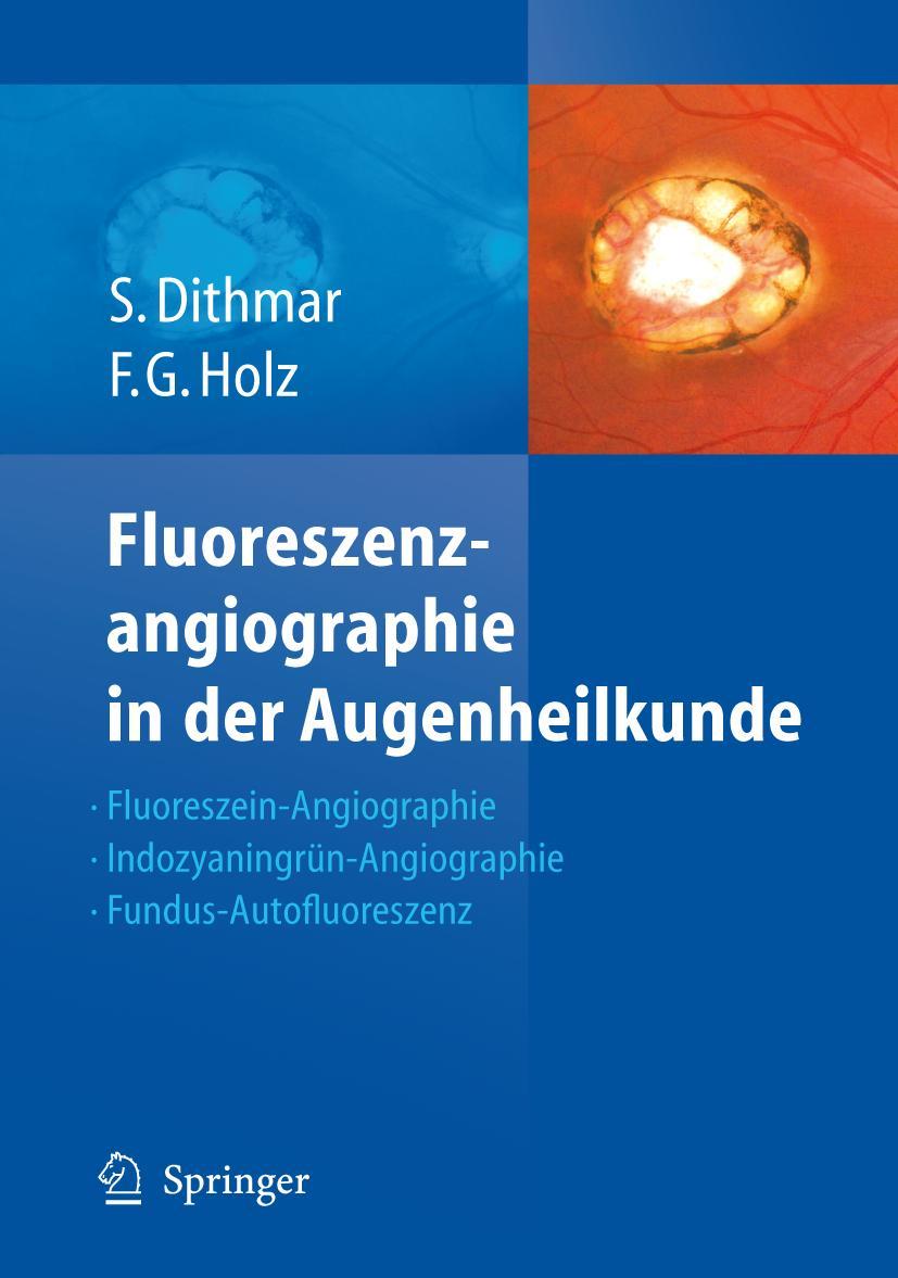 Vorderes Coverbild Fluoreszenzangiographie in der Augenheilkunde
