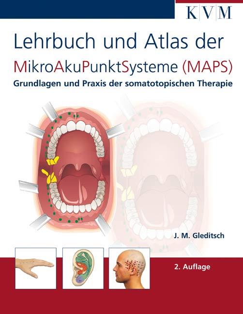 Vorderes Coverbild Mikro-Aku-Punkt-Systeme