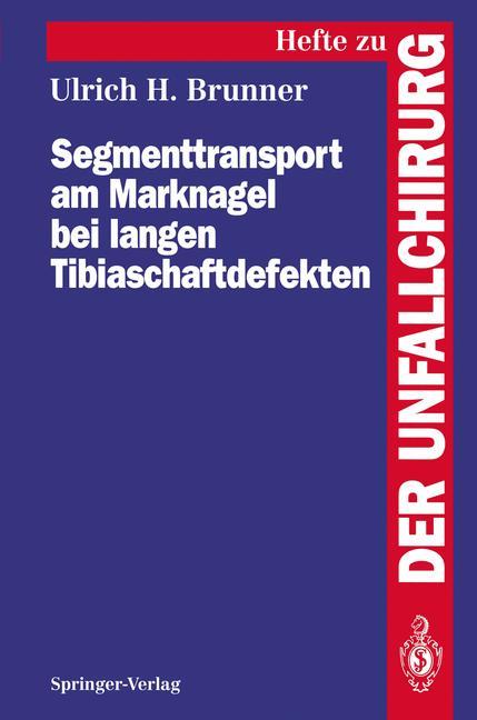 Vorderes Coverbild Segmenttransport am Marknagel bei langen Tibiaschaftdefekten